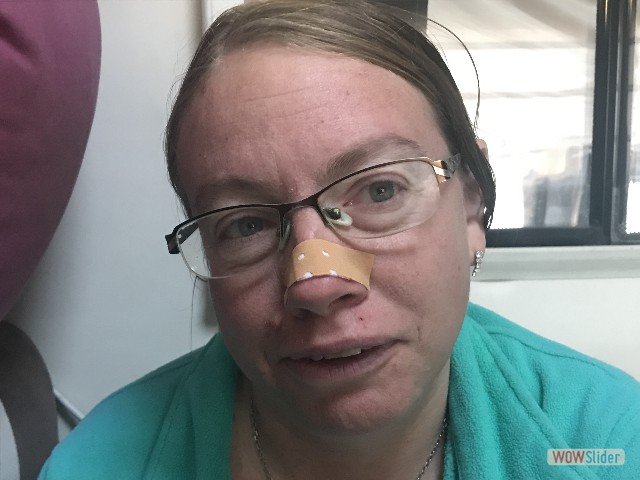 12_Aie, mal au nez 12_Aie, mal au nez